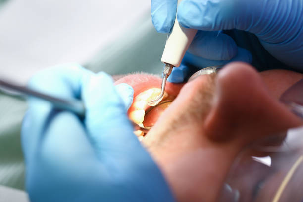 Best Same-Day Emergency Dentist in Grandview, OK
