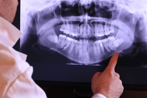 Best Weekend Emergency Dentist in Grandview, OK