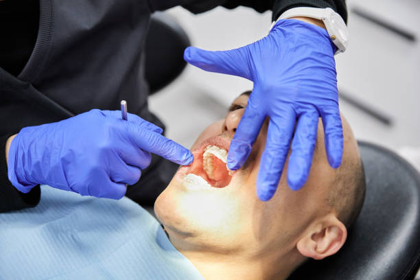 Best Emergency Tooth Extraction in Grandview, OK